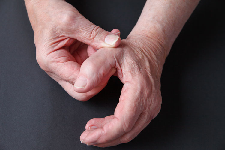 Base-of-thumb-arthritis