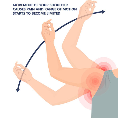 Movement-of-your-shoulder
